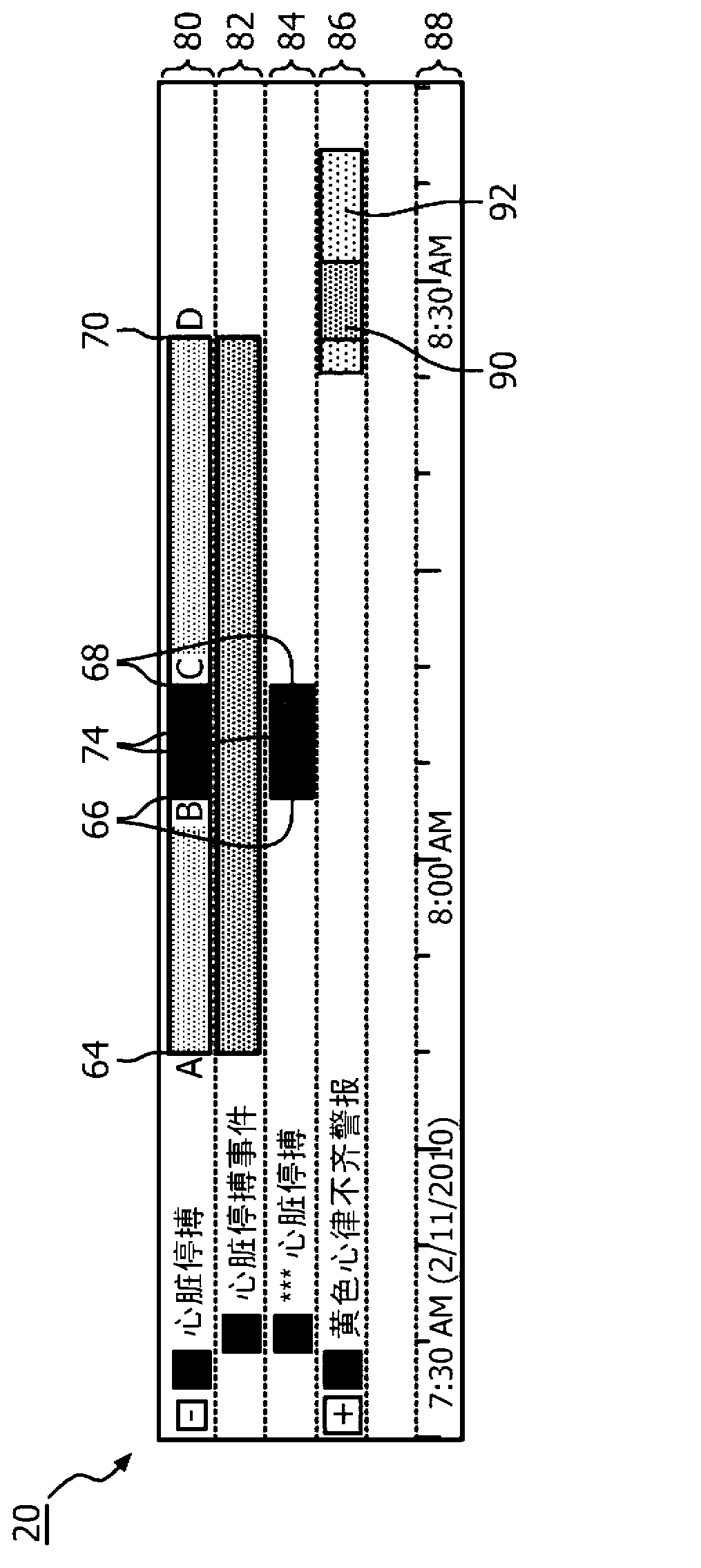 Method for display and navigation to clinical events