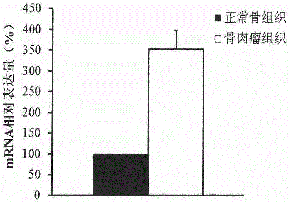 Application of WWP1 gene in preparing products for diagnosing osteosarcoma and drugs for treating osteosarcoma