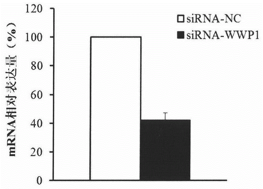 Application of WWP1 gene in preparing products for diagnosing osteosarcoma and drugs for treating osteosarcoma