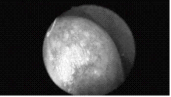 Multi-spectrum nasal cavity endoscope real-time image enhancement method and endoscope imaging system