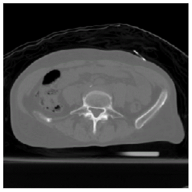 A Segmentation Method for Inhomogeneous Medical Images