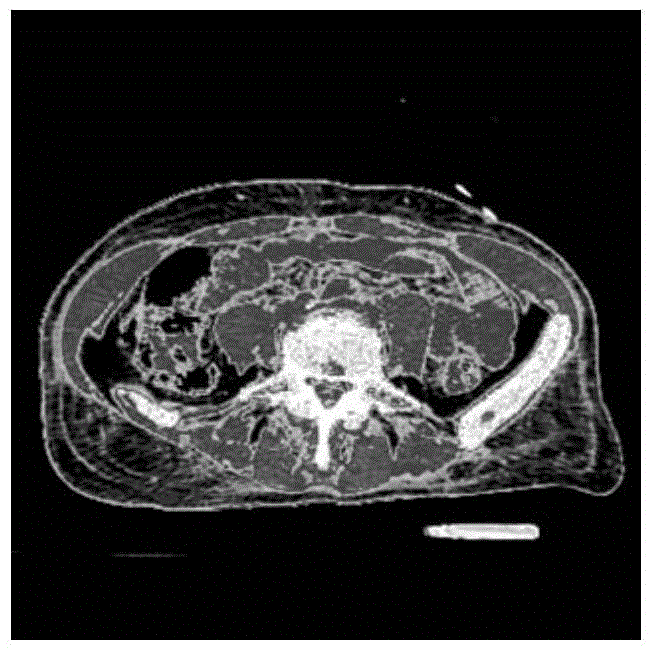 A Segmentation Method for Inhomogeneous Medical Images