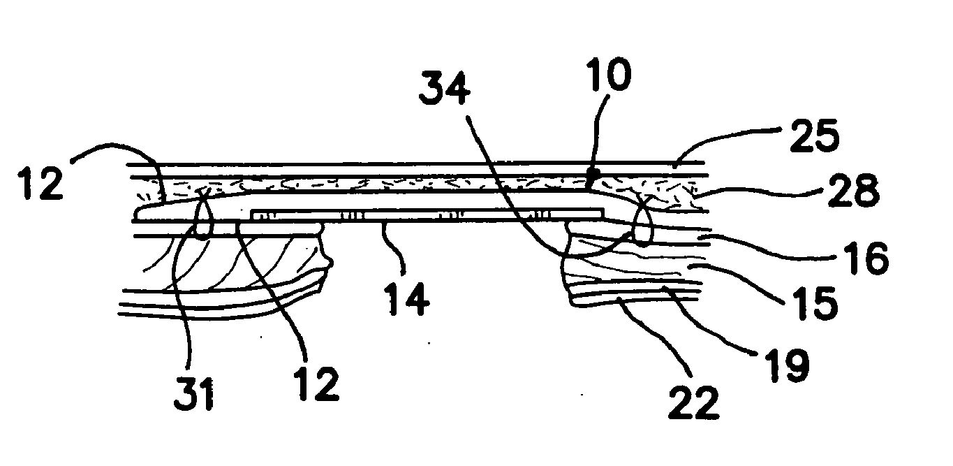 Surgical prosthesis having biodegradable and nonbiodegradable regions