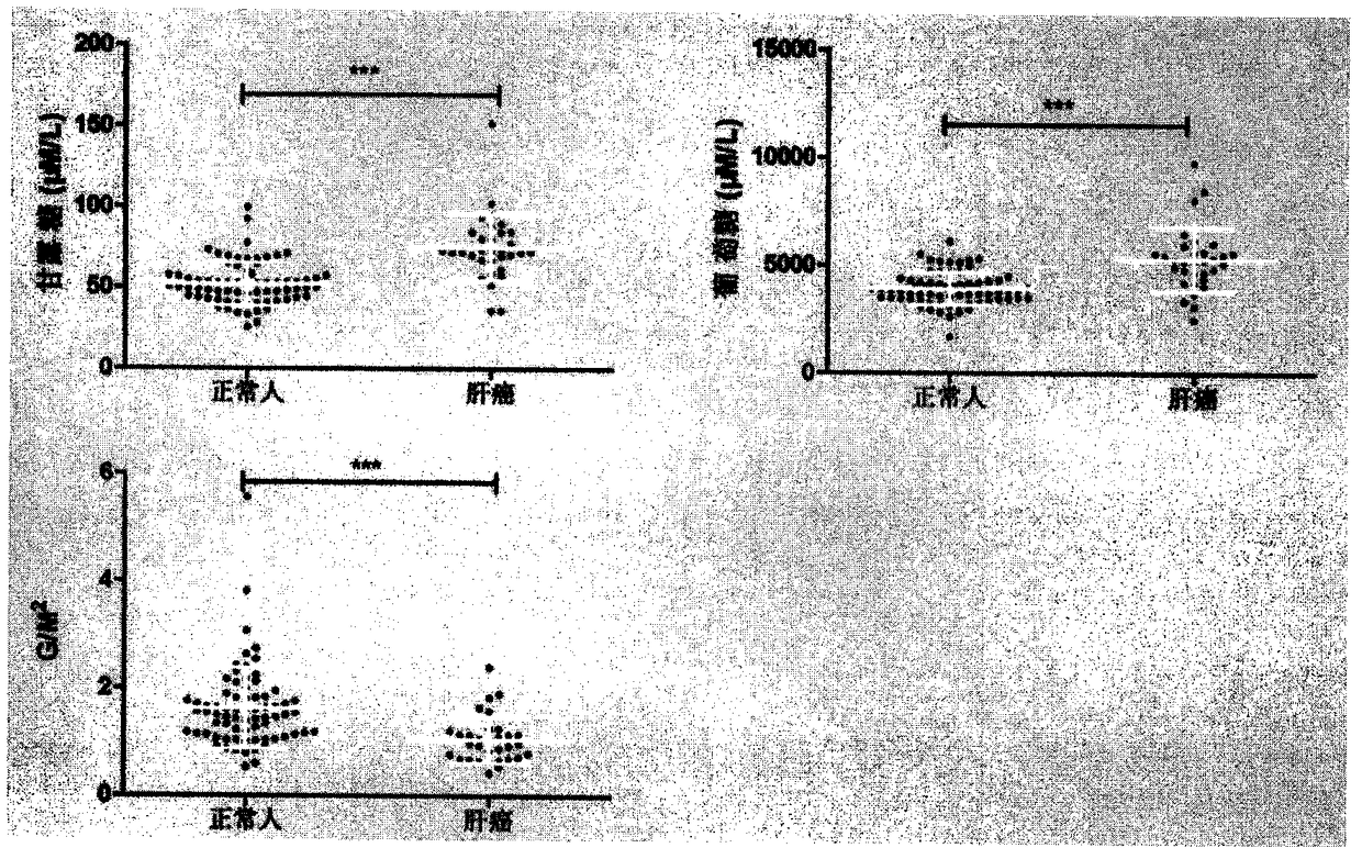 Method for authenticating liver cancer biomarker and detection kit thereof