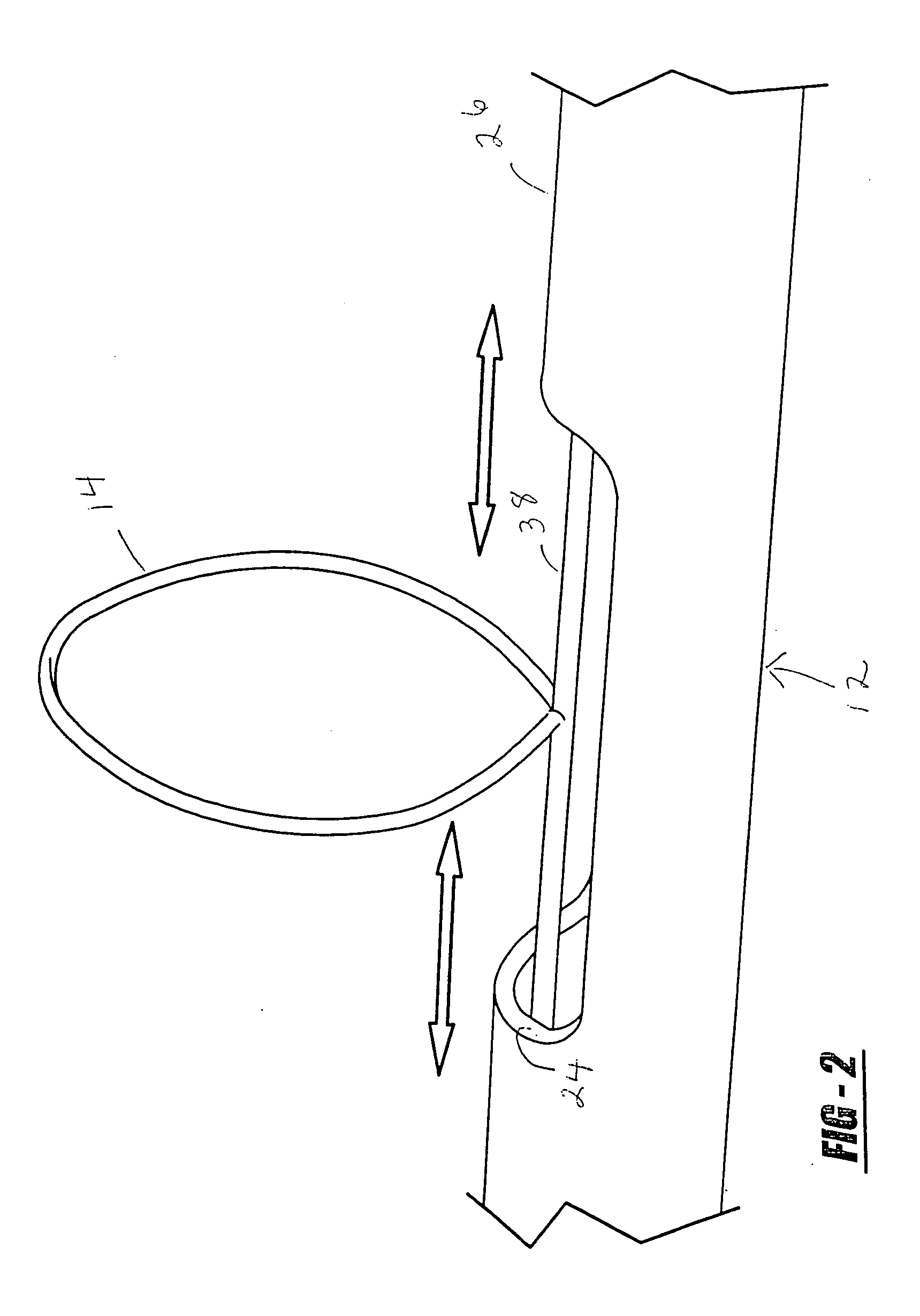 Filter retrieval catheter system, and methods