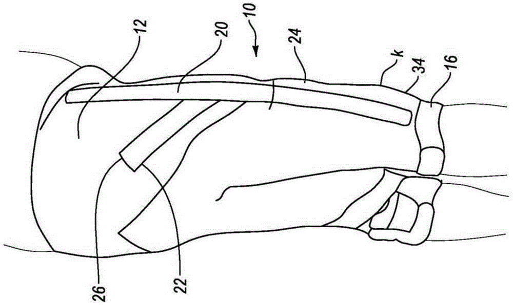 Orthopedic device for treating complications of the hip