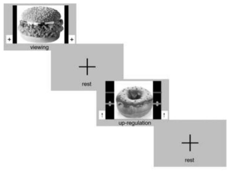 Neural feedback method for improving obesity based on real-time functional magnetic resonance