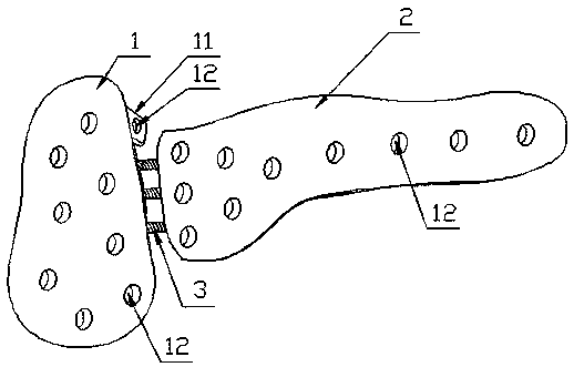 Acromioclavicular joint belt cross-linking combined bionic steel plate