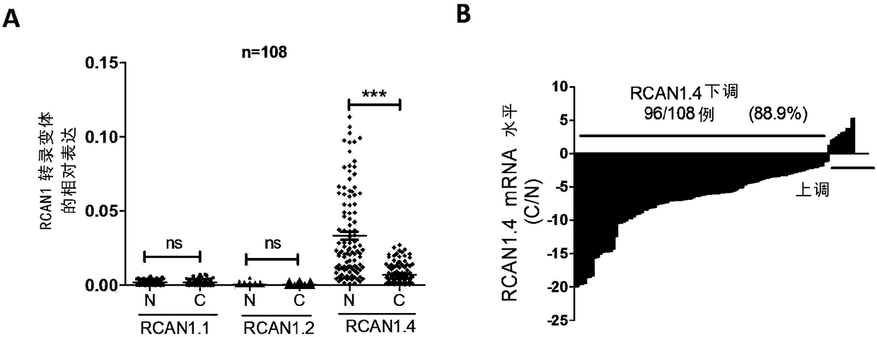 Applications of regulator of calcineurin 1.4 or analogues thereof in preparing medicines for inhibiting liver cancer