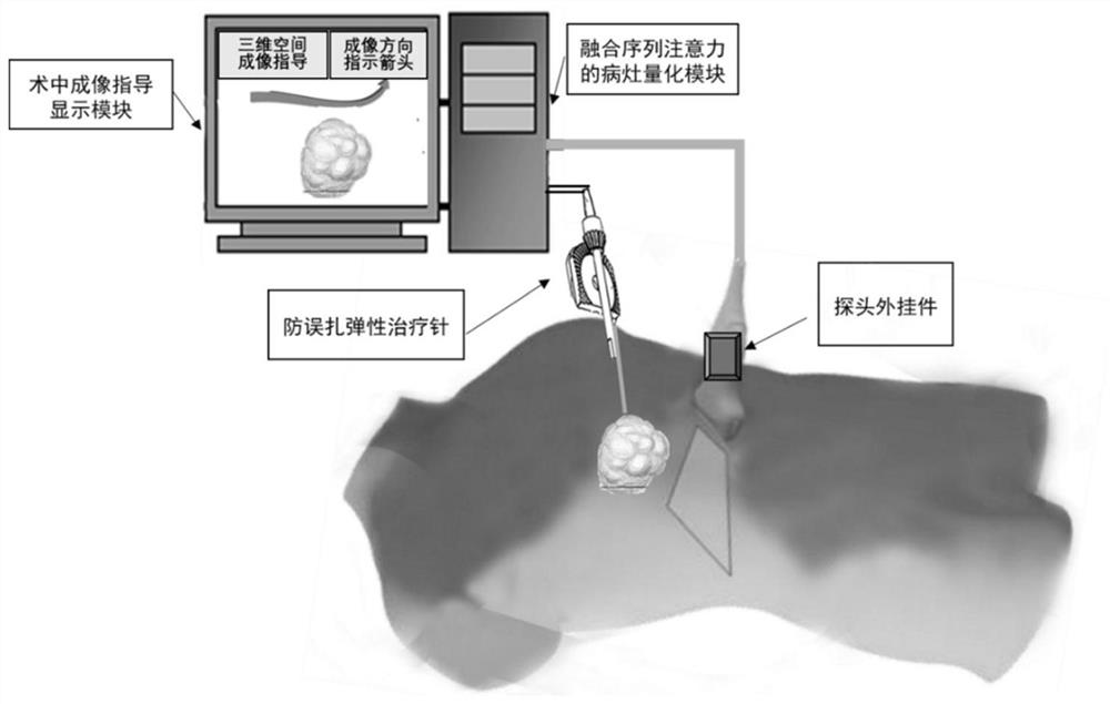 Focus imaging and mistaken pricking prevention treatment system combined with ultrasonic autonomous scanning