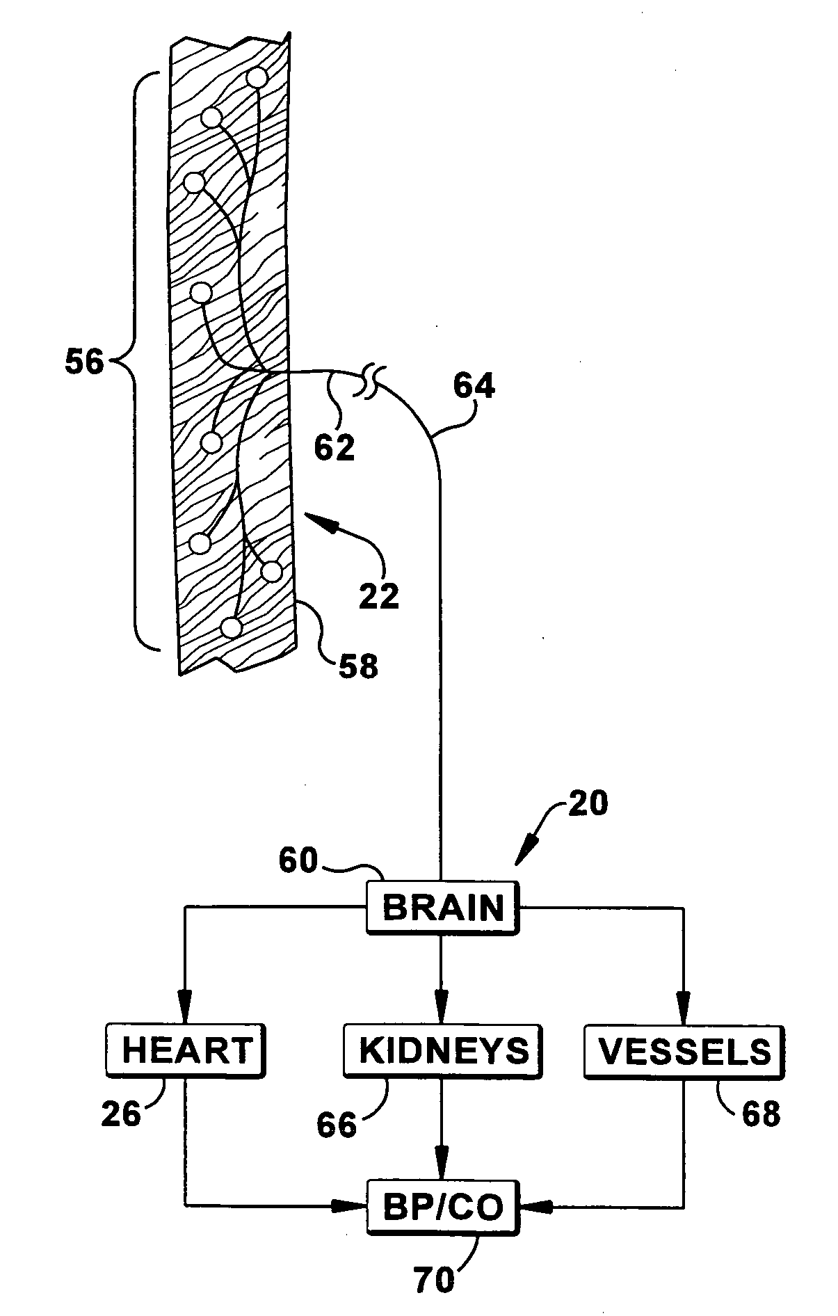 Apparatus and method for modulating the baroreflex system