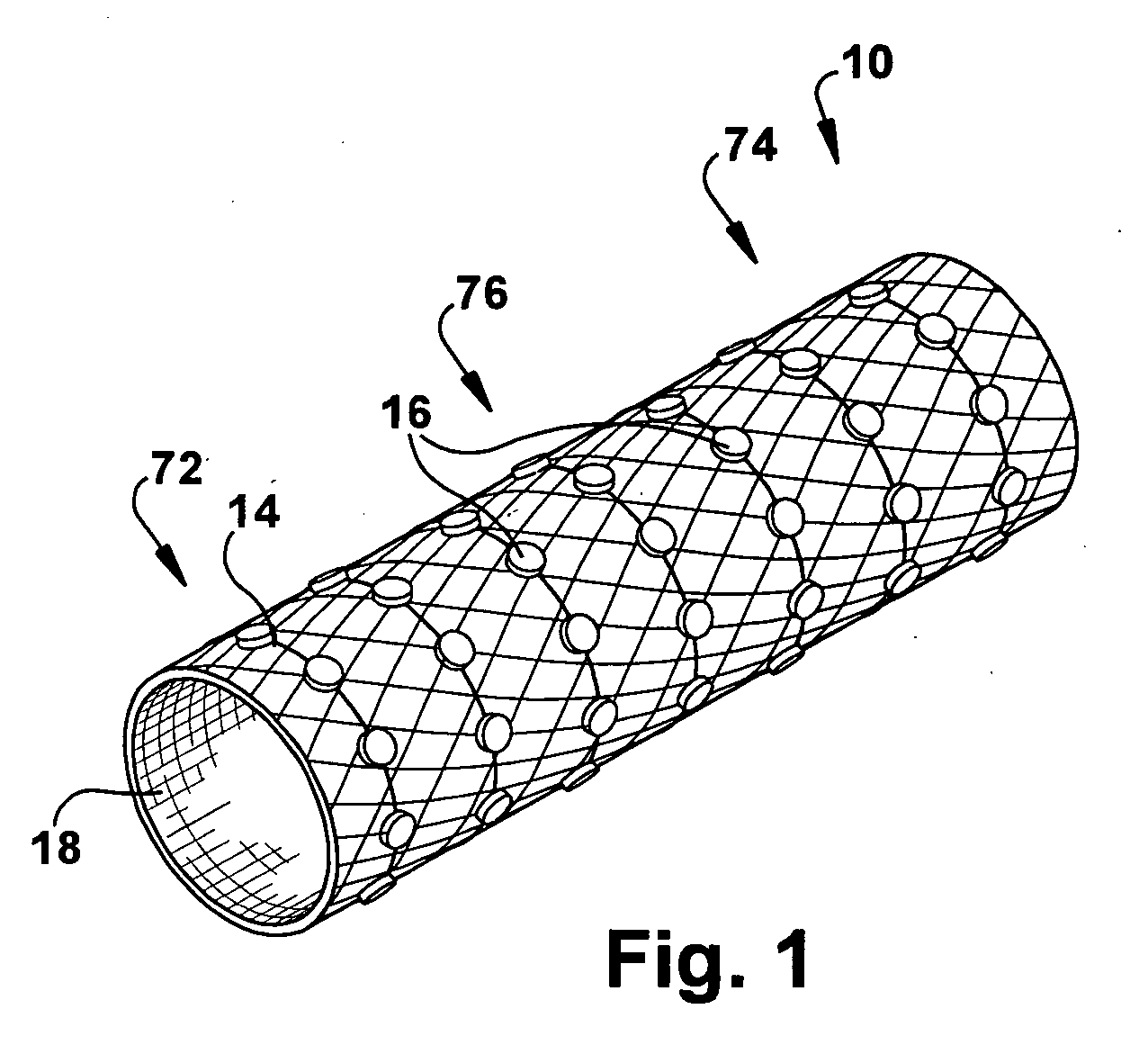 Apparatus and method for modulating the baroreflex system