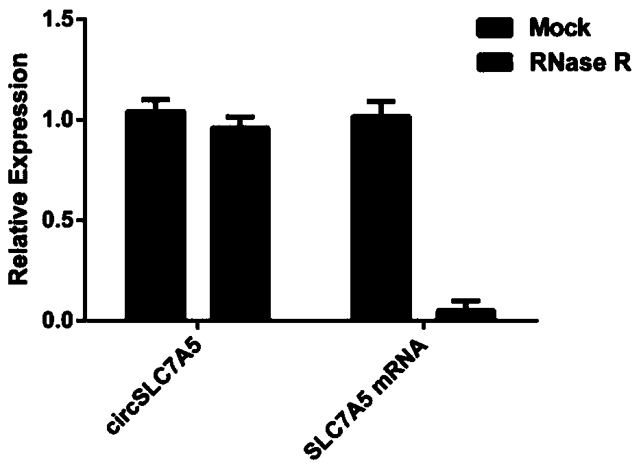 Application of circ_slc7a5 molecular markers in blood in the diagnosis and prognosis of esophageal squamous cell carcinoma