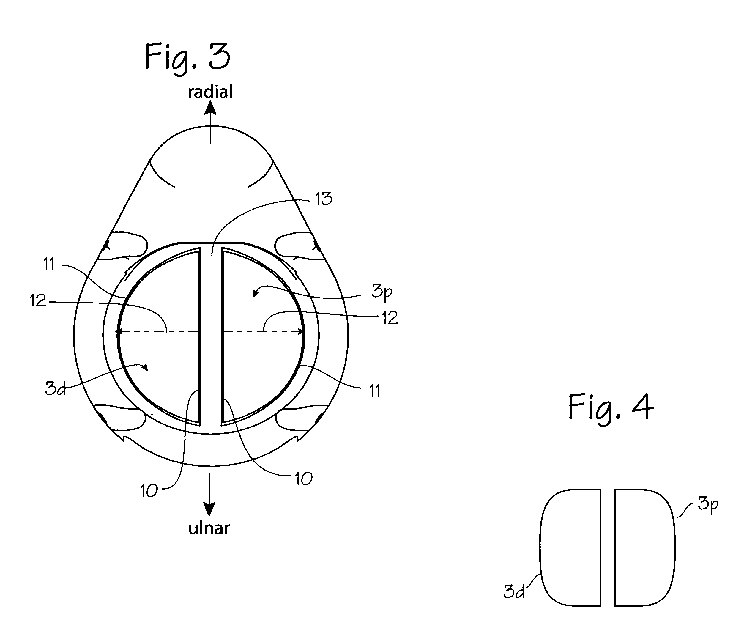 Electro-acupuncture device with D-shaped stimulation electrodes