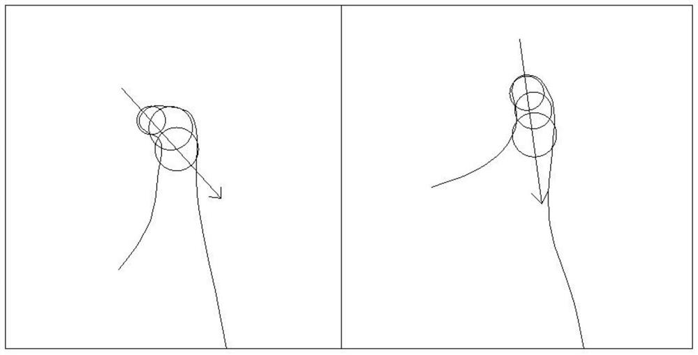 Quantitative measurement and analysis system for temporal-mandibular joint on magnetic resonance image