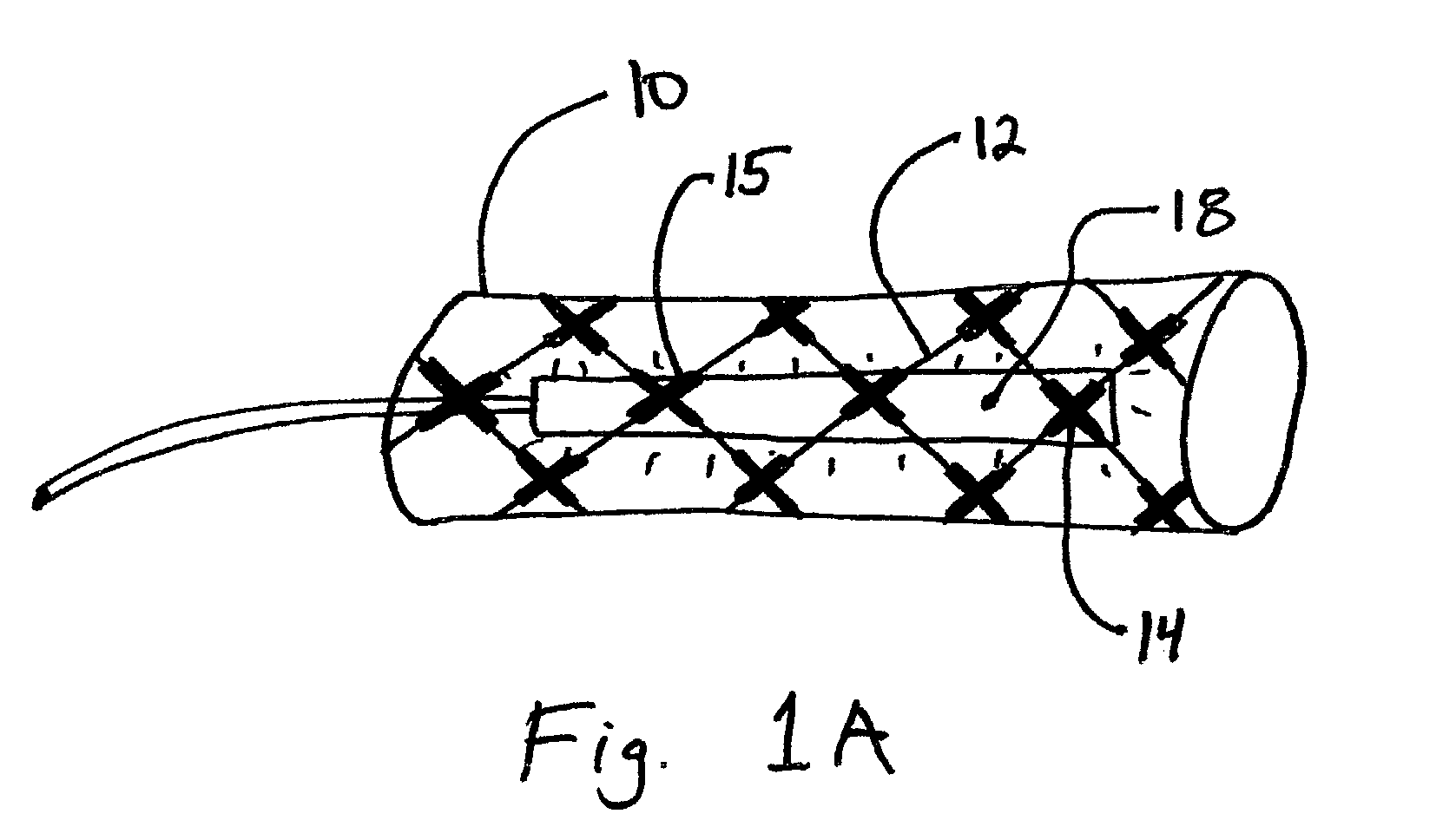 Photocurable endoprosthesis system