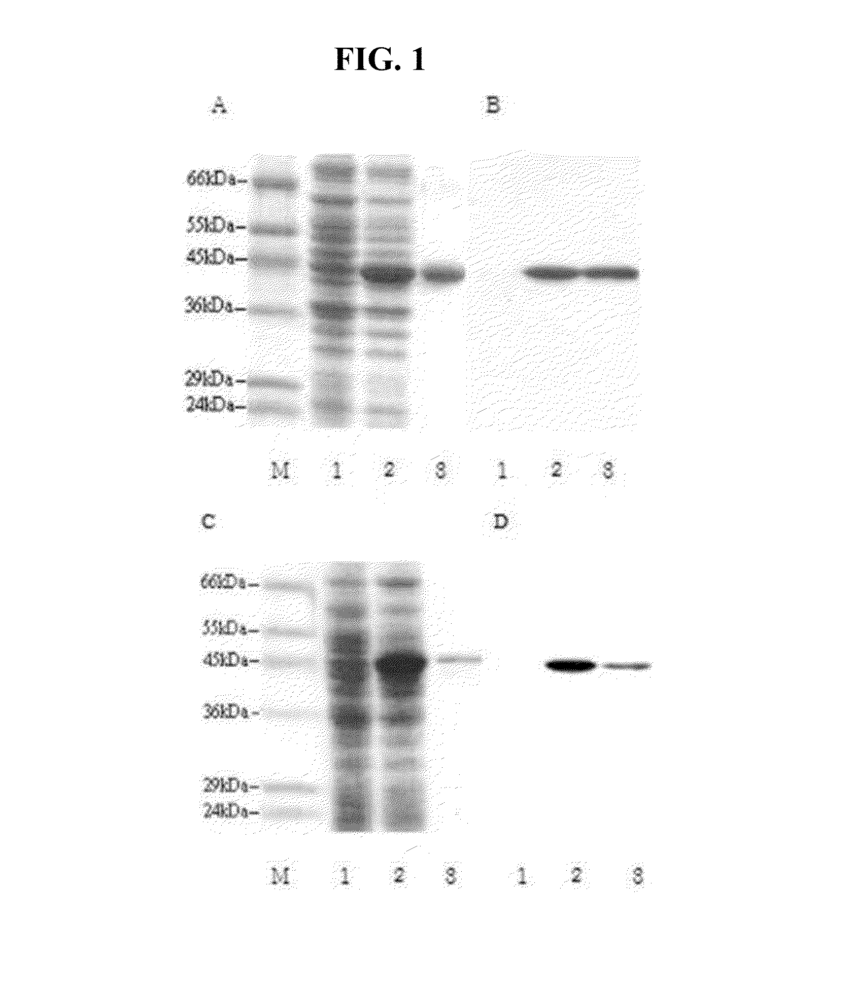 Kit and method for diagnosis, prognosis or monitoring of liver disease through measurement of amount of ast