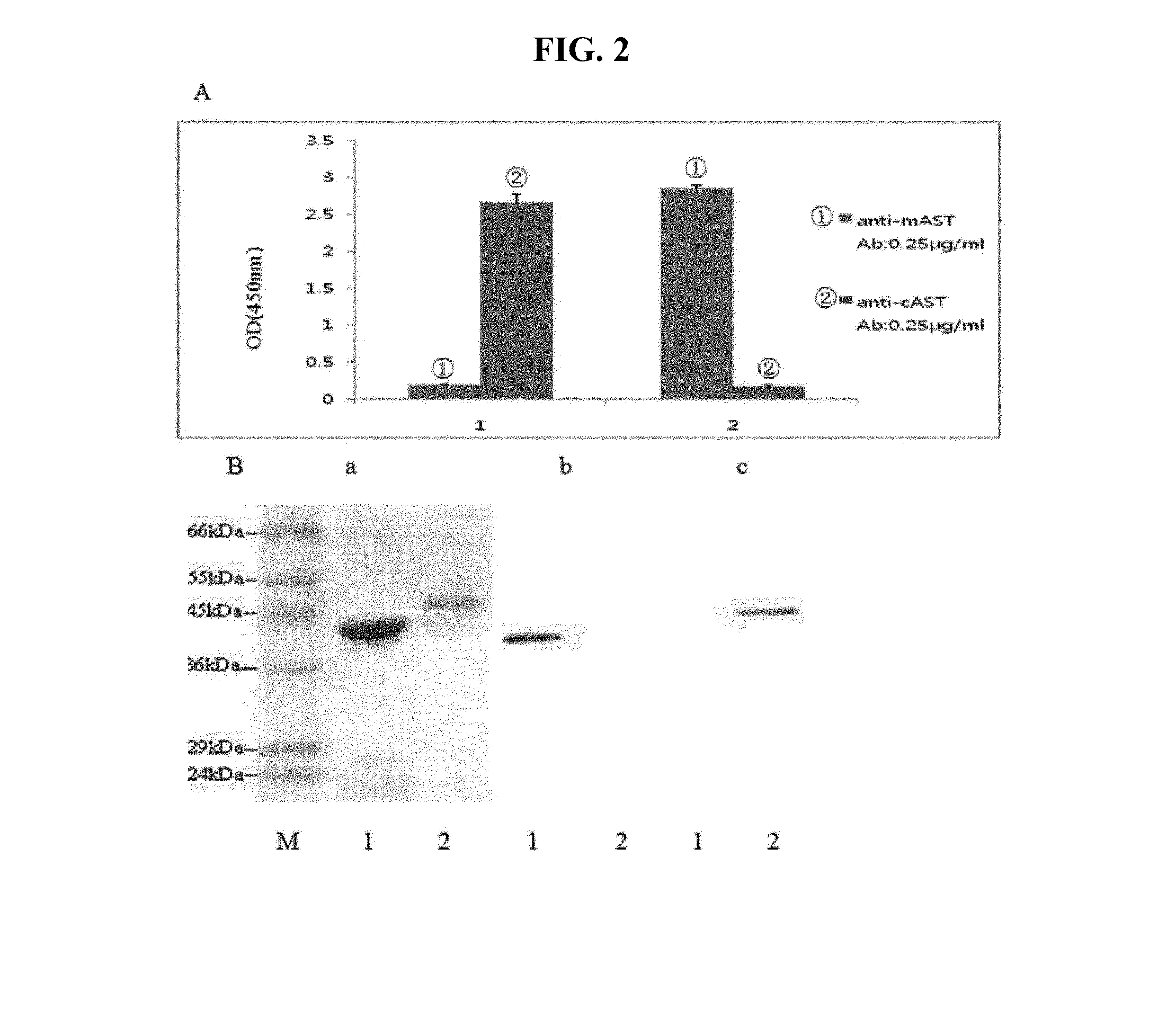 Kit and method for diagnosis, prognosis or monitoring of liver disease through measurement of amount of ast