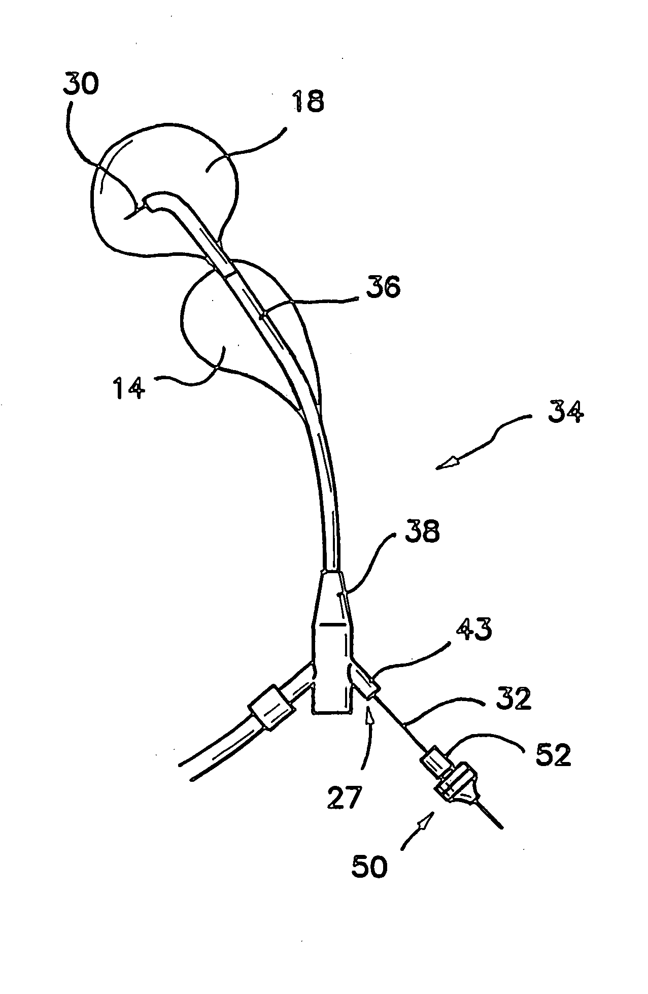 Surgical gel seal