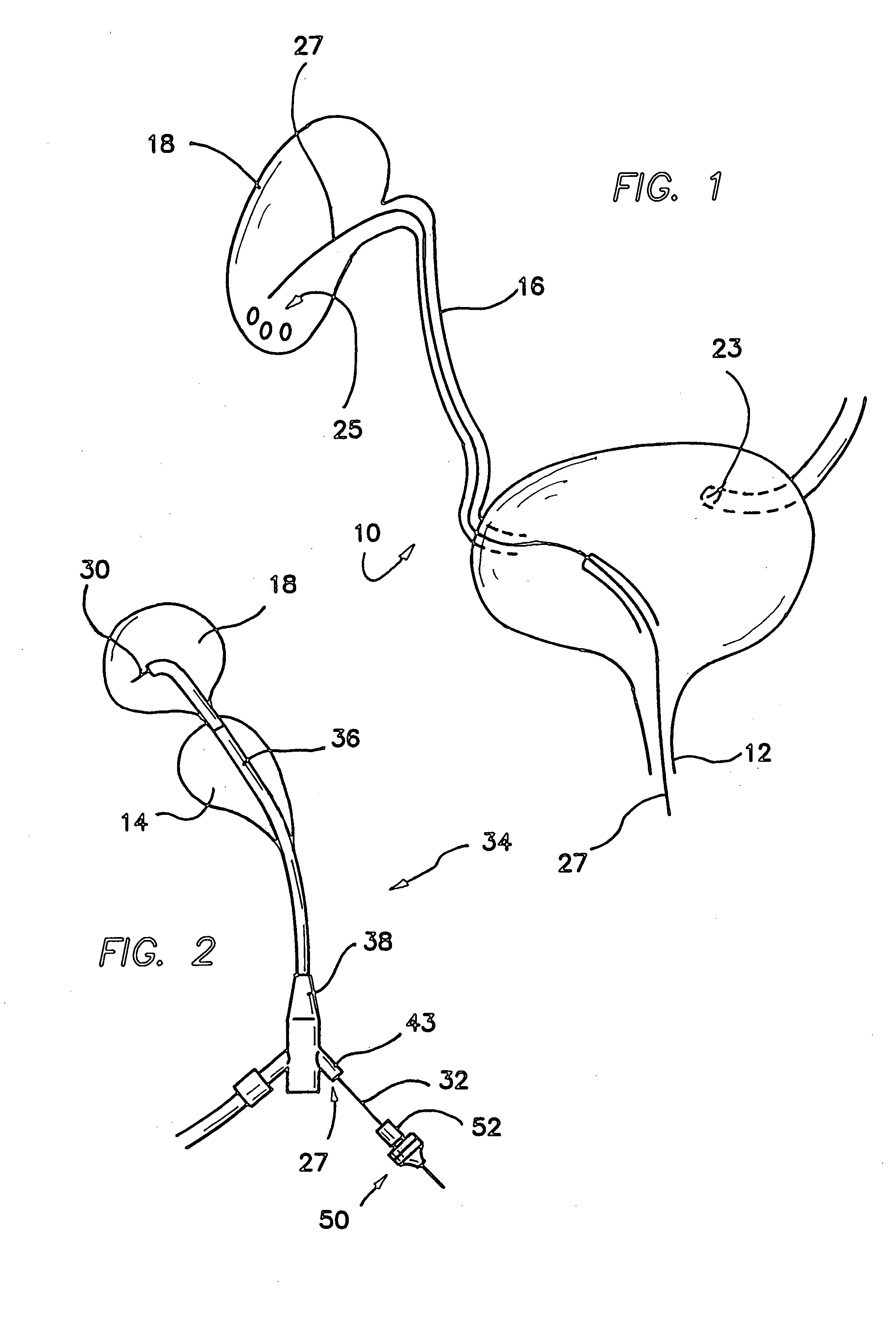 Surgical gel seal