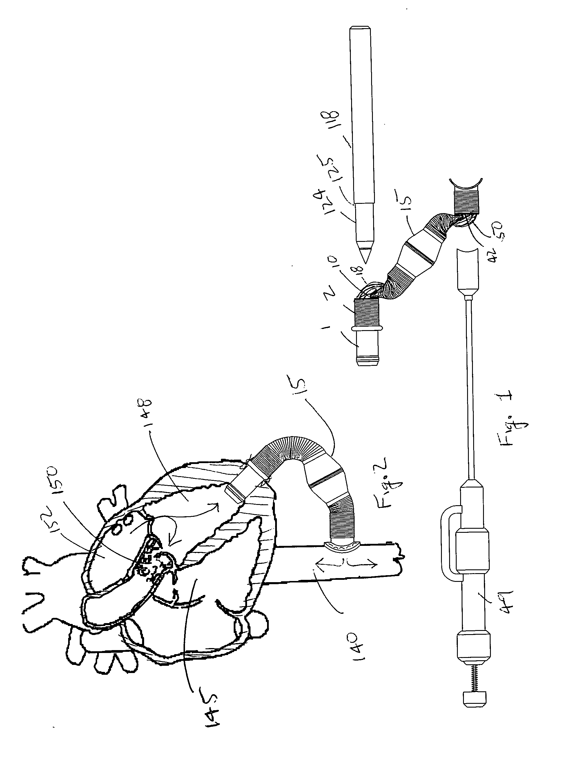 Valve bypass graft device, tools, and method