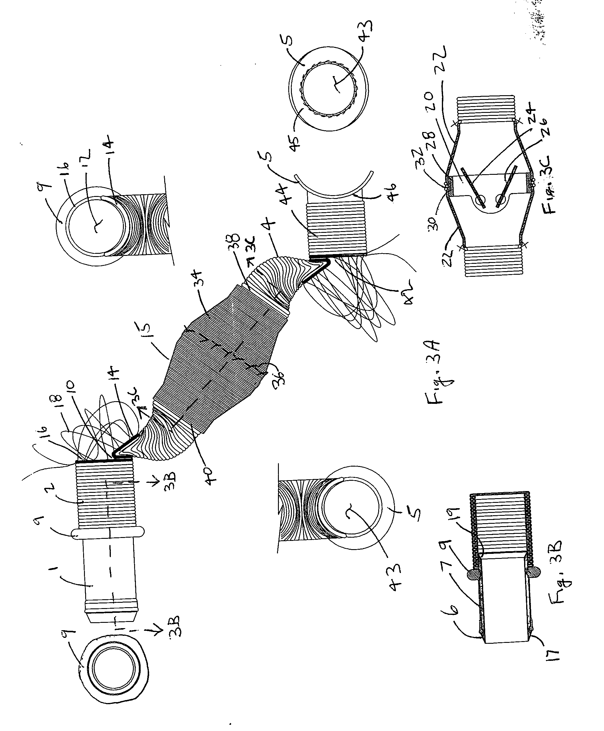 Valve bypass graft device, tools, and method