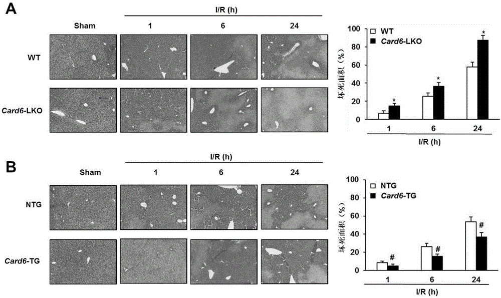 Application of Caspase recruitment domain protein 6 (Card6) in hepatic ischemia reperfusion injury