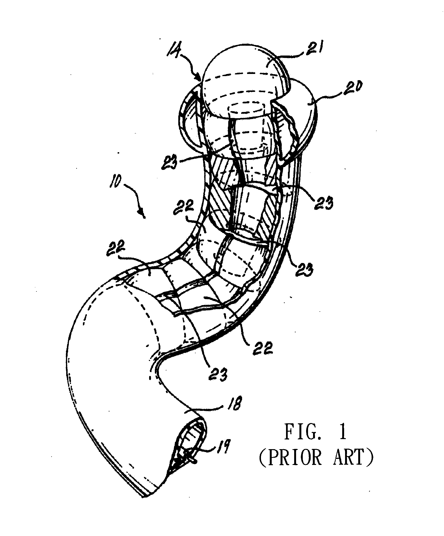 Endoscopy apparatus having high degree of motion freedom and operating method thereof