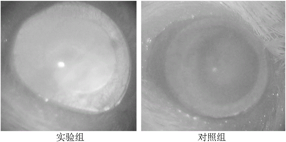 Herpes simplex keratitis (HSK) vaccine and preparation method thereof