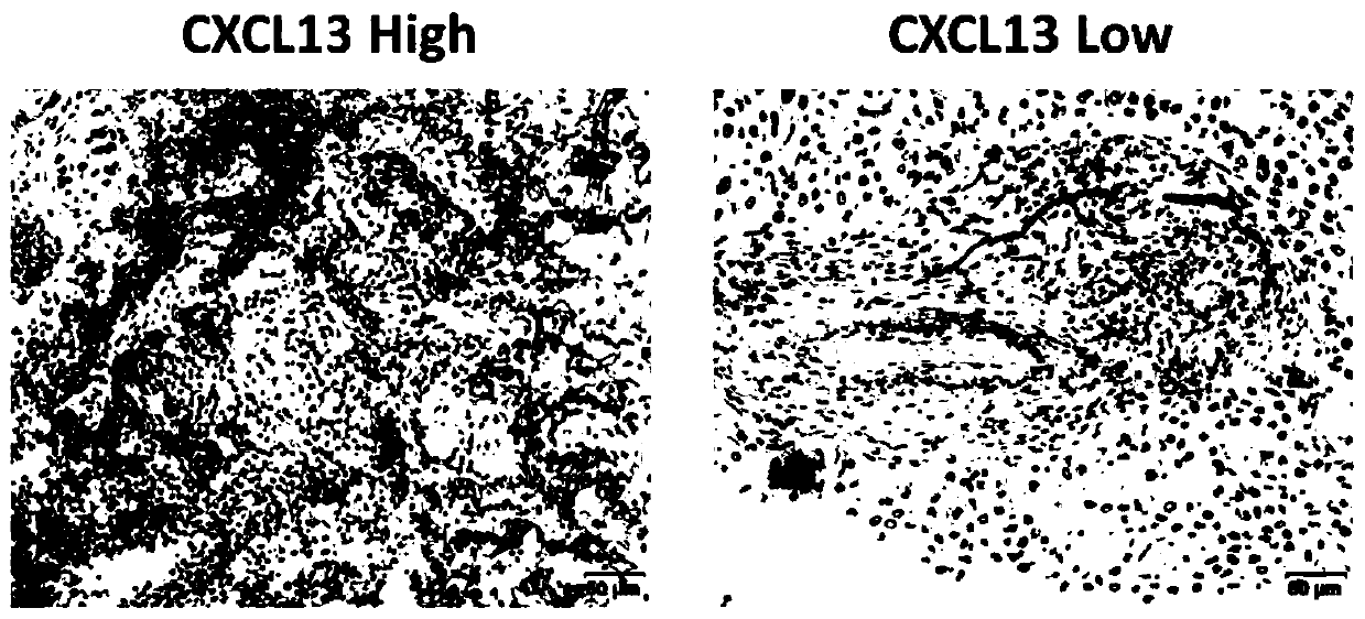 Application of CXCL13 detection agent in preparation of kit for predicting immunotherapy effect