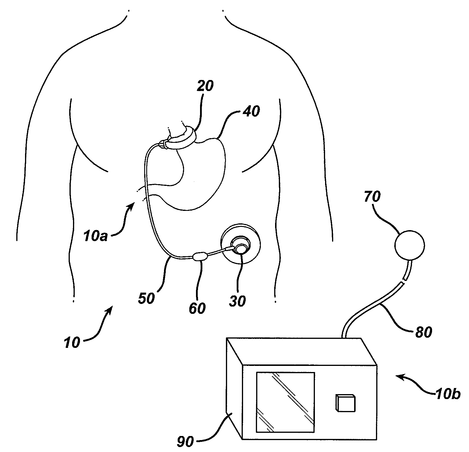 Optimizing the operation of a restriction system