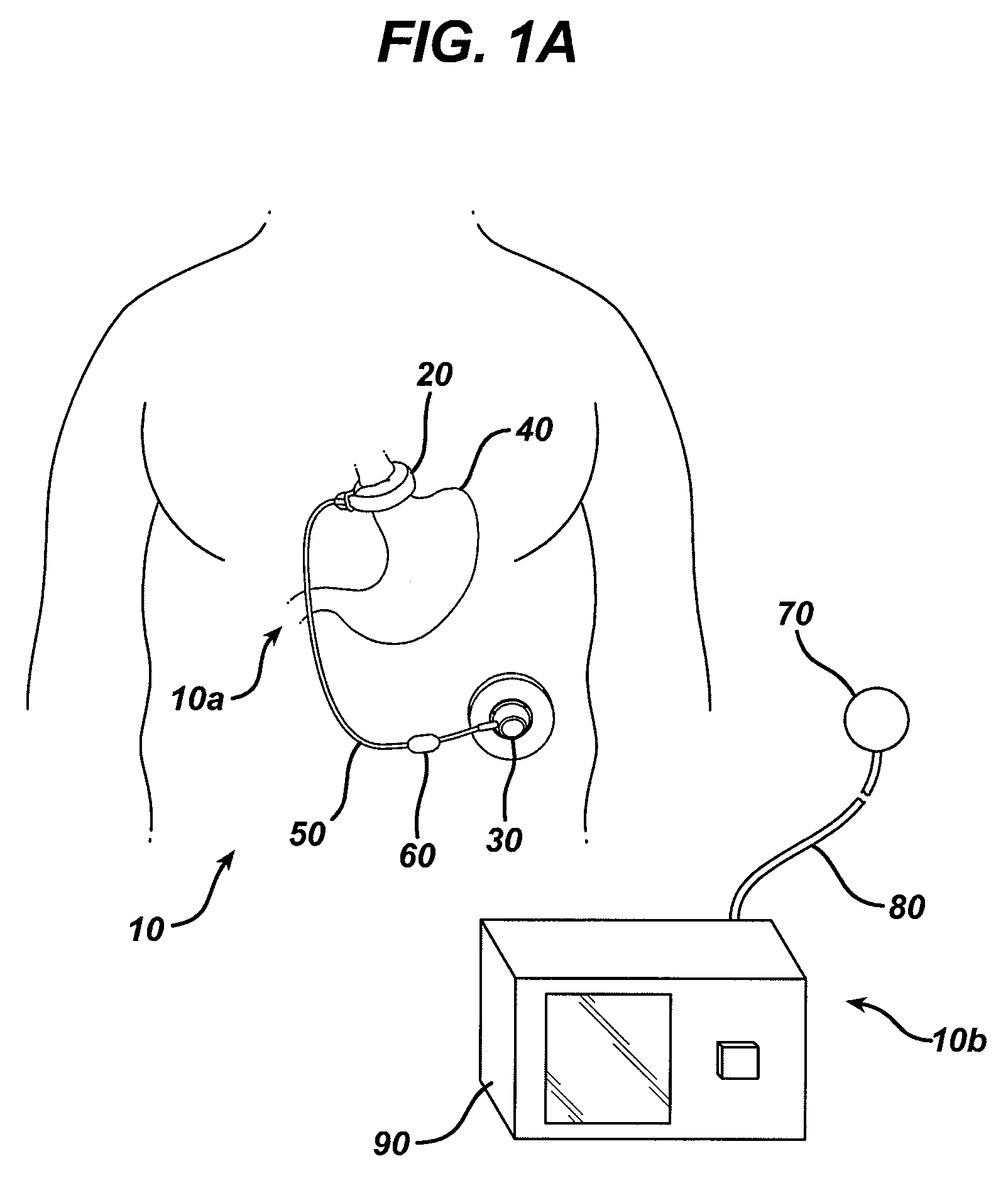 Optimizing the operation of a restriction system