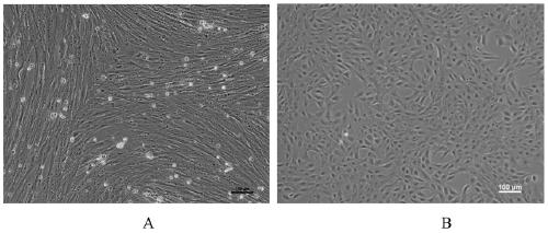 A method for constructing a koi brain cell line and its application