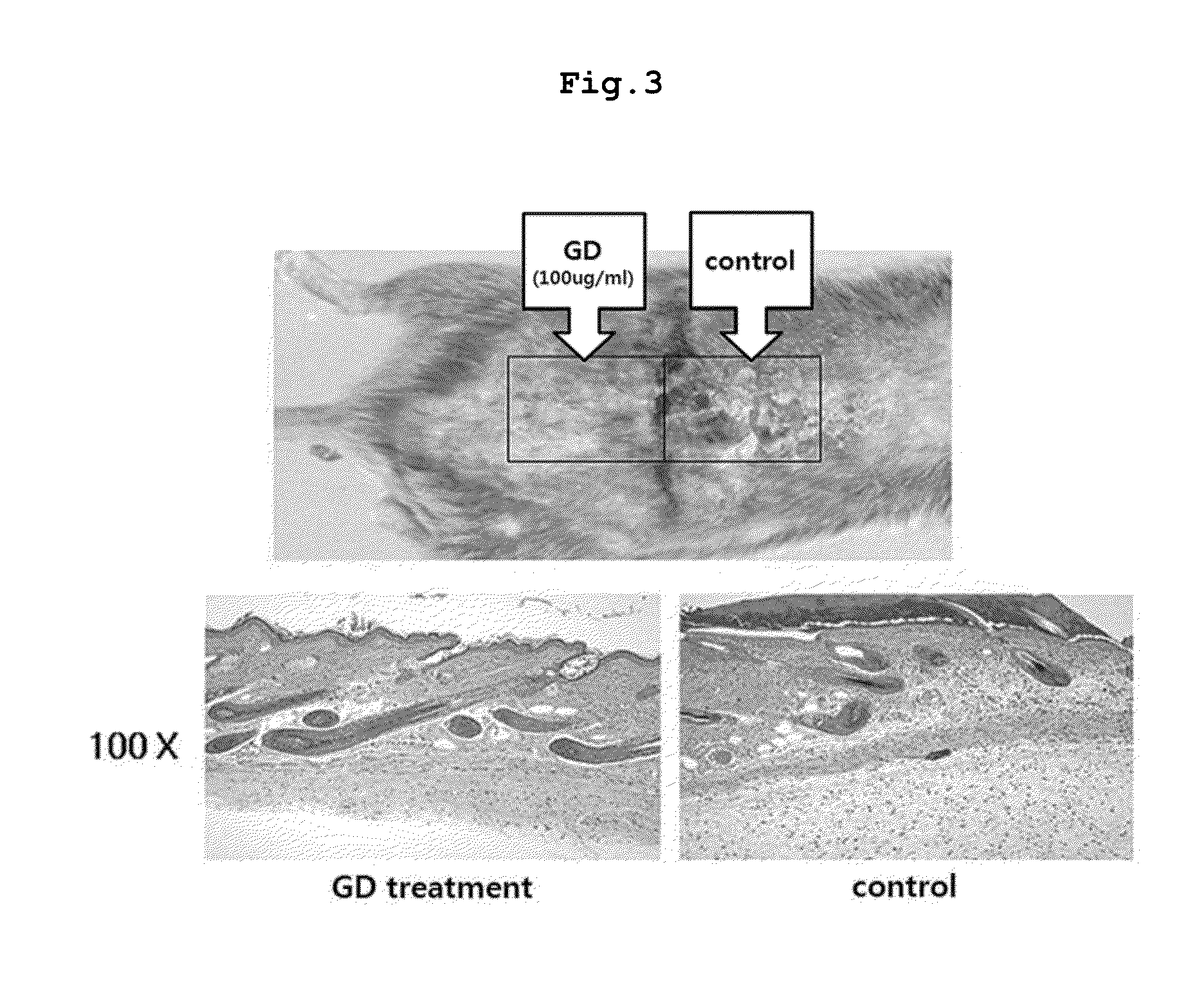 Daphne genkwa extracts, and pharmaceutical composition containing fractions of the extracts or compounds separated from the extracts as active ingredients for preventing or treating atopic dermatitis