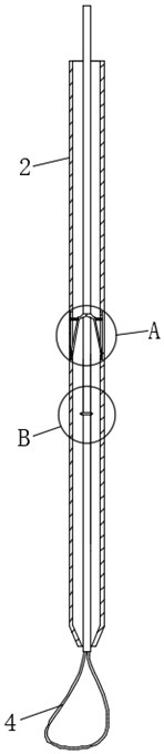 Vena Cava Filter Grabber