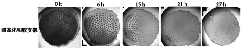 Photo-crosslinking/electrostatic spinning preparation and application of hydrogel composite scaffold with double-layer skin structure