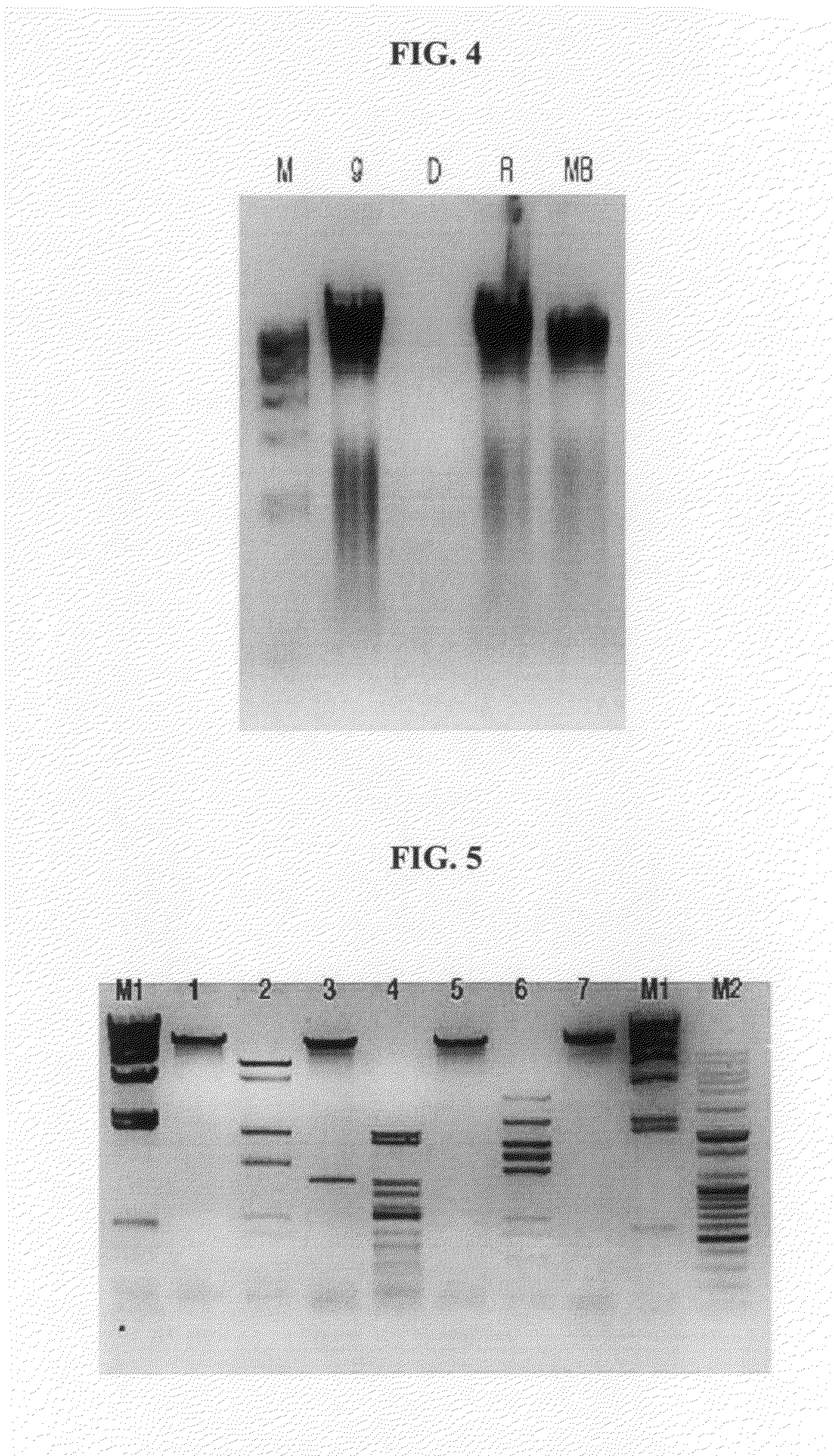 Podoviriedae bacteriophage having killing activity specific to staphylococcus aureus