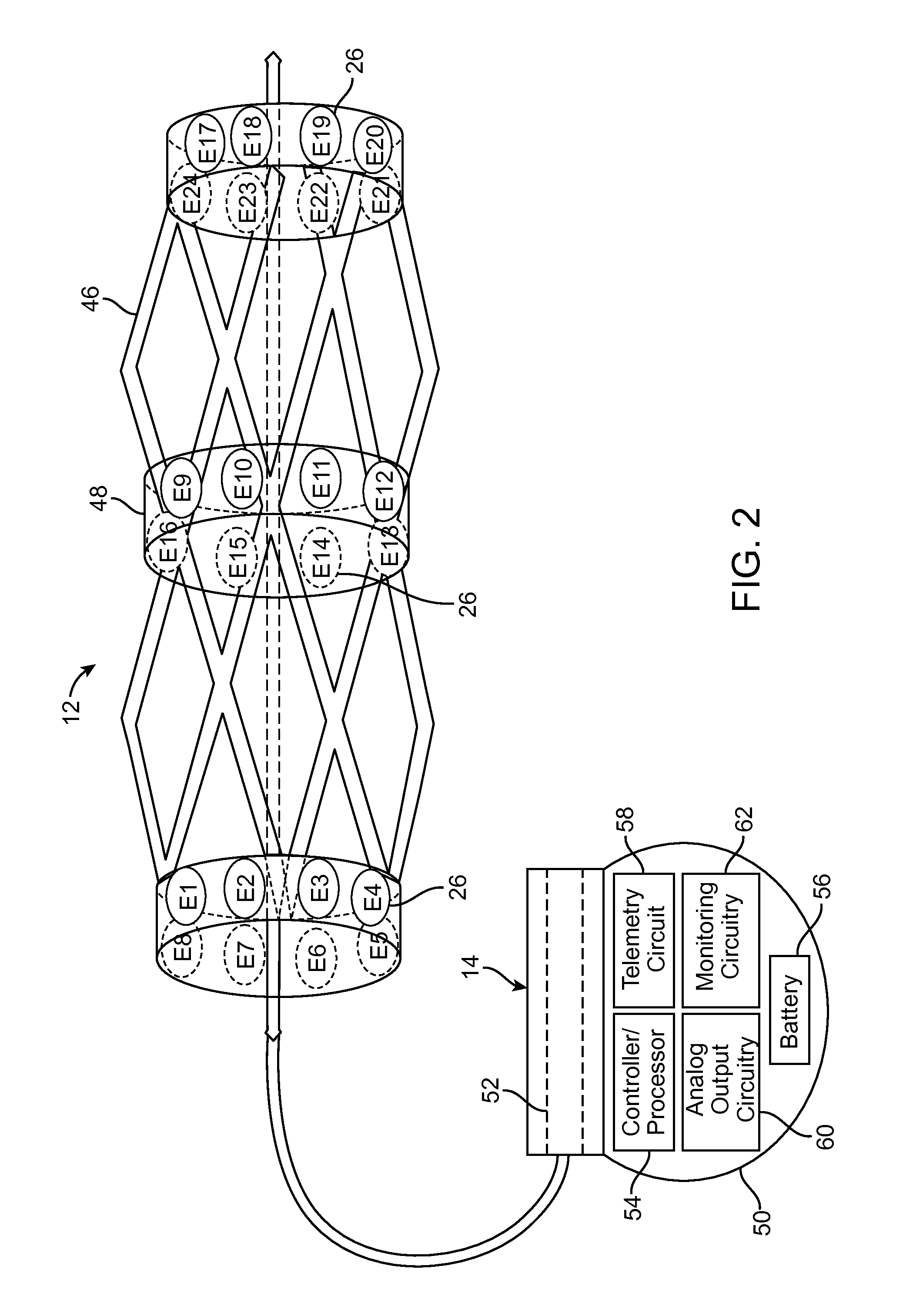 Neuromodulation of renal nerve for treatment of hypertension