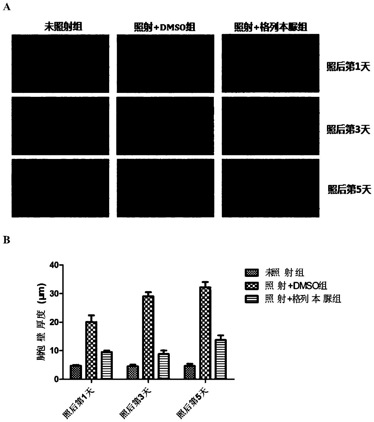 Application of Glibenclamide in Preparation of Drugs for Protecting Radiation-induced Lung Injury