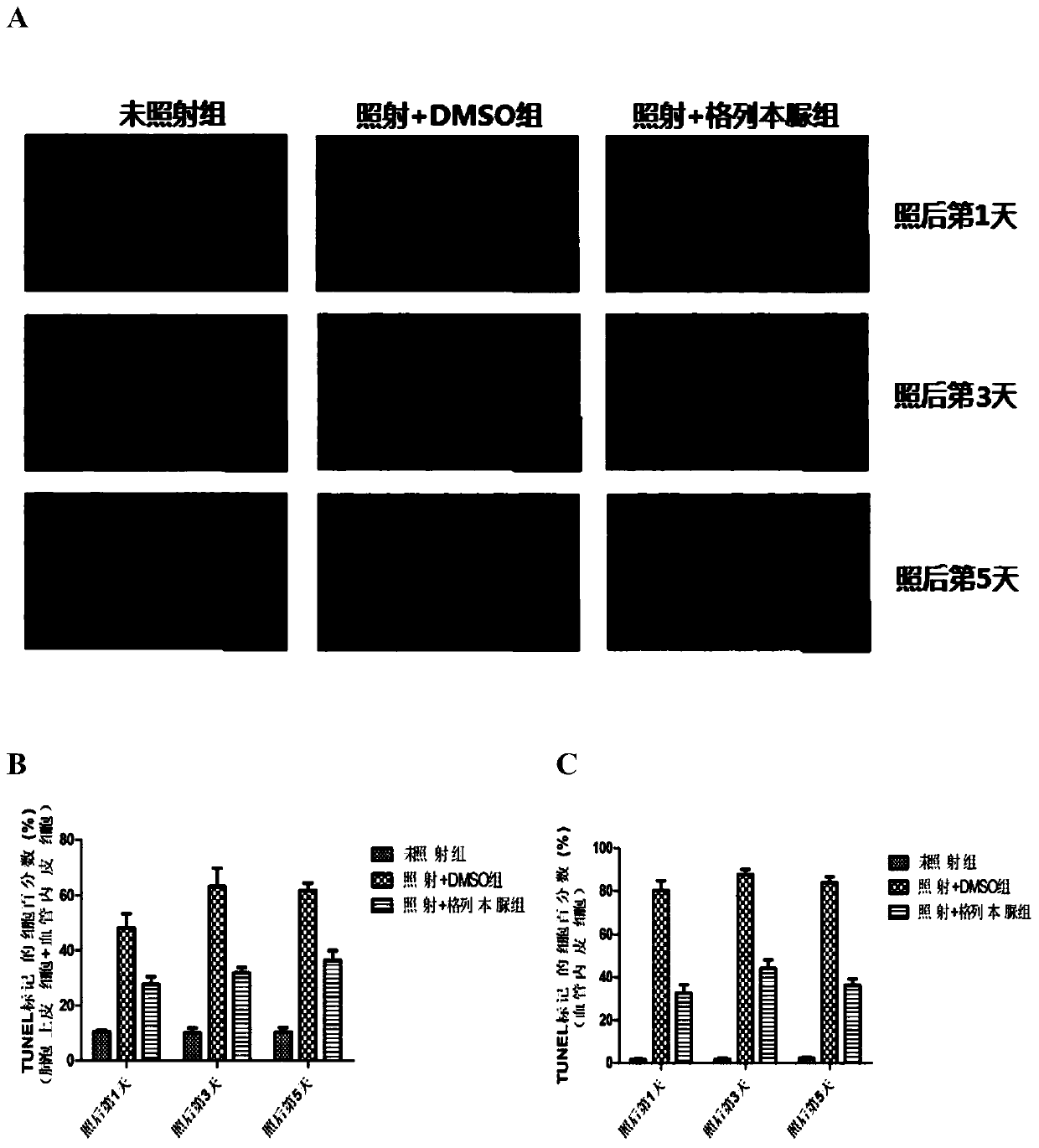 Application of Glibenclamide in Preparation of Drugs for Protecting Radiation-induced Lung Injury