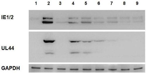 Preparation method of Anji white tea polysaccharides and novel use of the polysaccharides against human cytomegalovirus