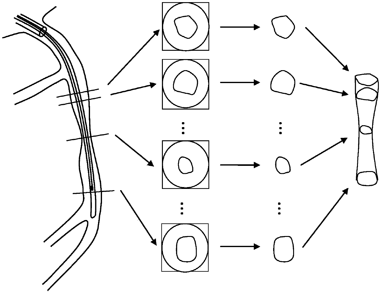 High-precision matching model-based method for calculating coronary artery parameters