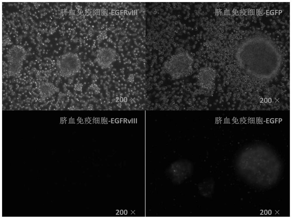 A chimeric antigen receptor, chimeric antigen receptor umbilical cord blood nucleated cells and application thereof