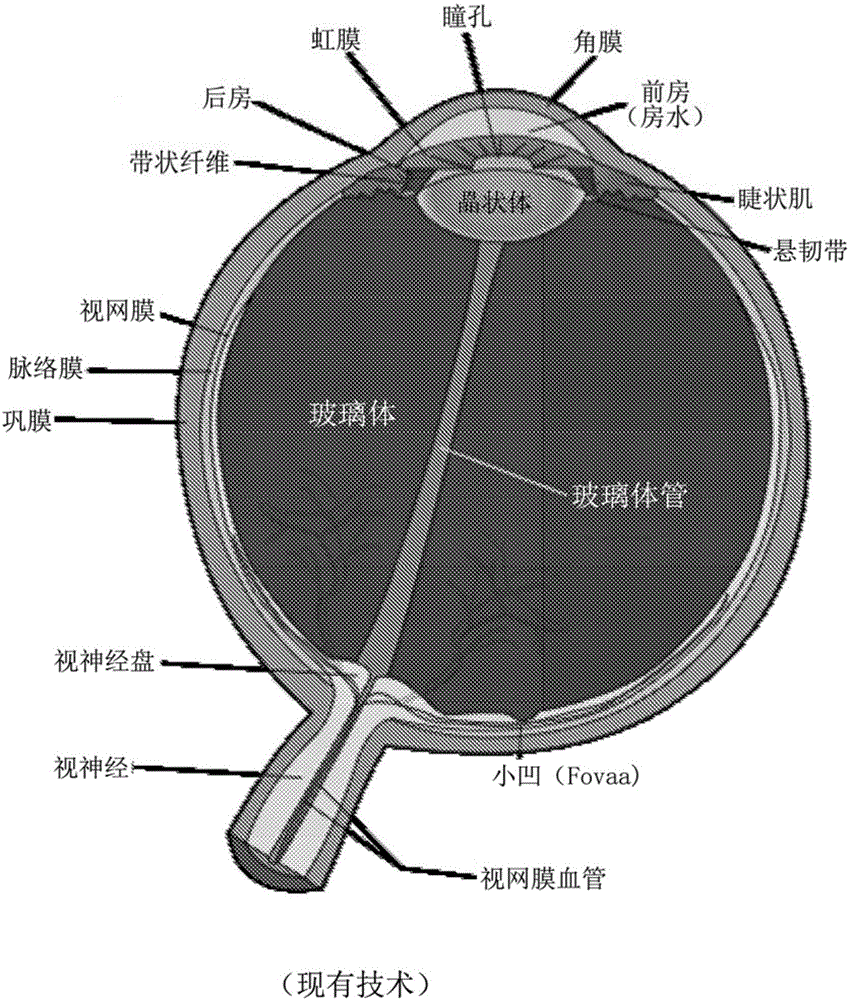 Method and apparatus for improved endothelial implantation