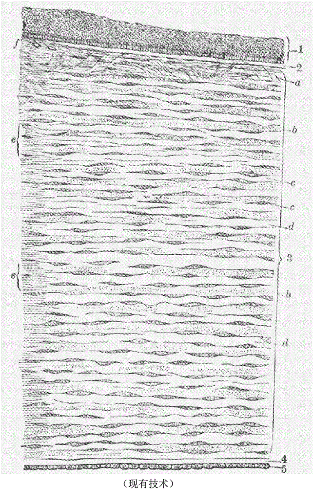 Method and apparatus for improved endothelial implantation