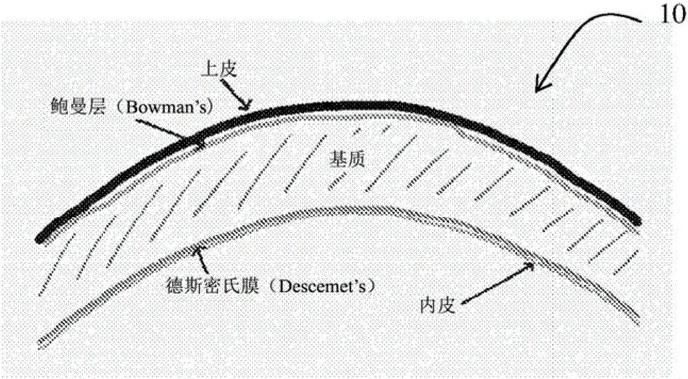 Method and apparatus for improved endothelial implantation