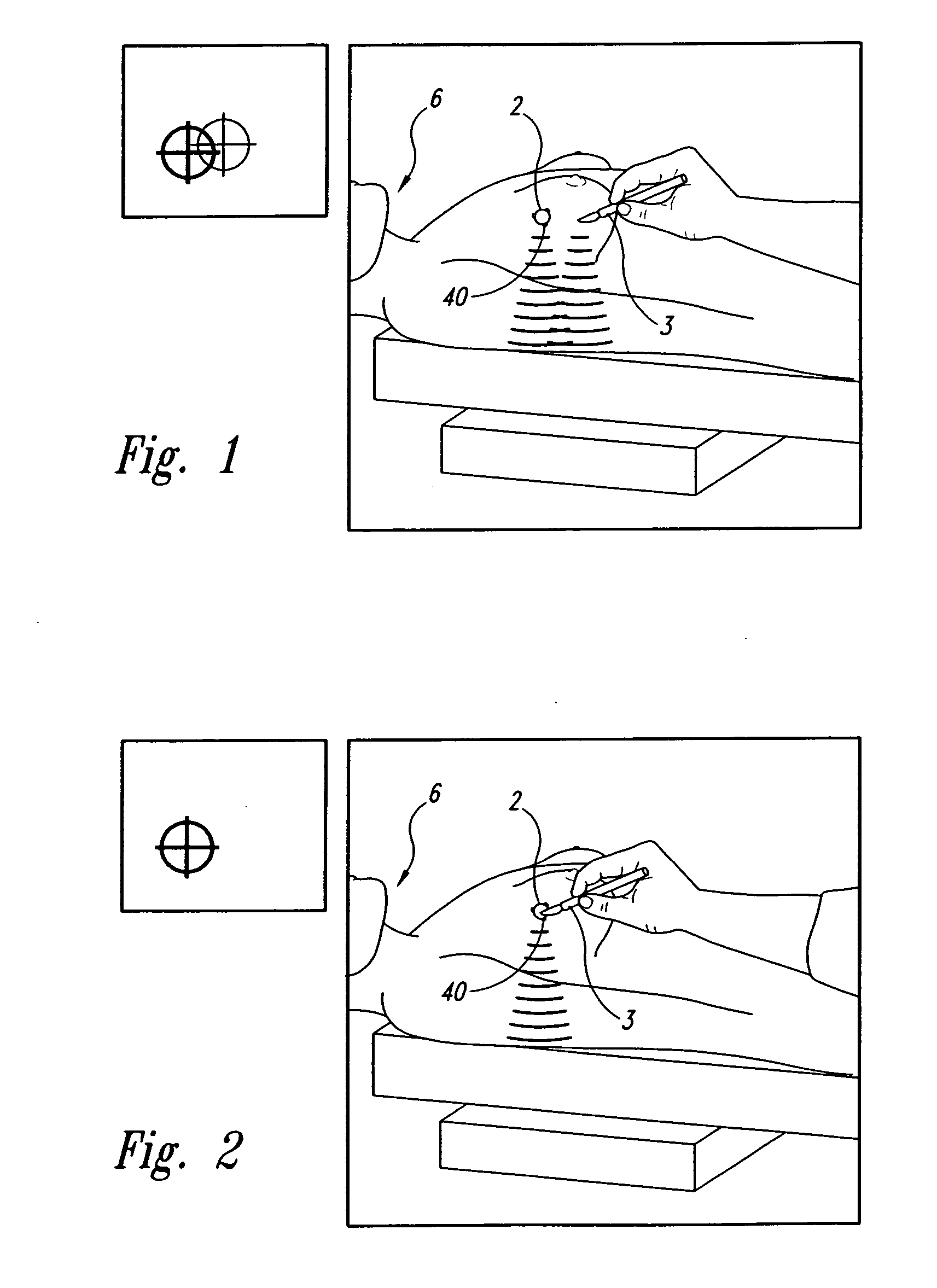 Systems and methods for treating a patient using radiation therapy