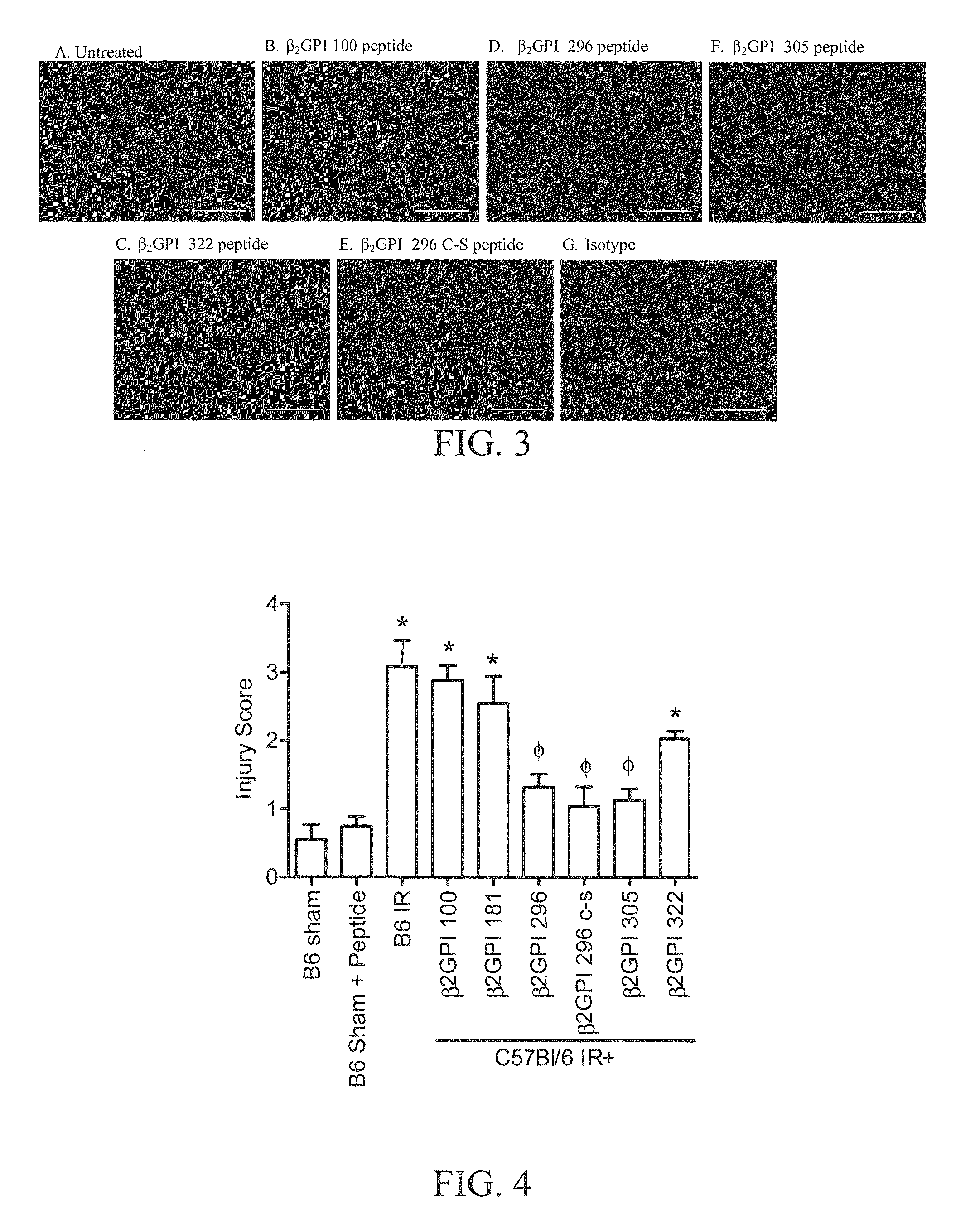 β2-glycoprotein I peptide inhibitors