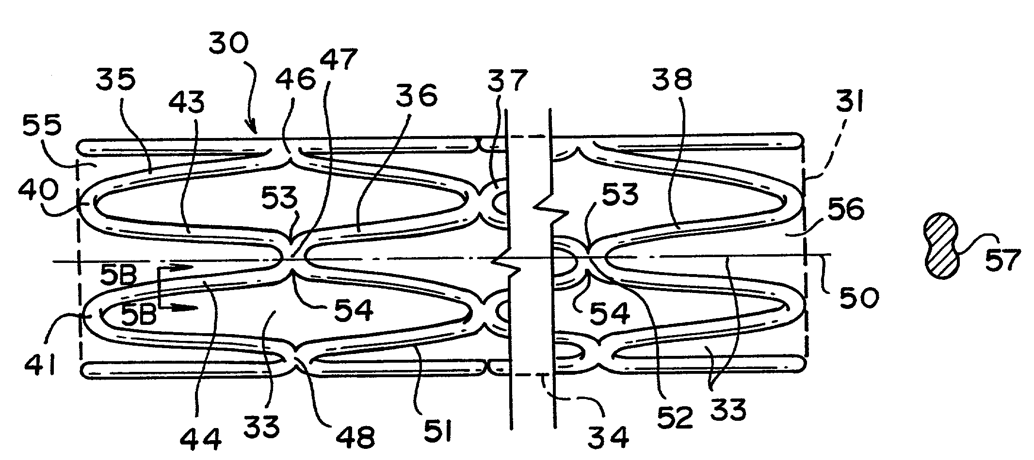 Tubular stent with oval struts