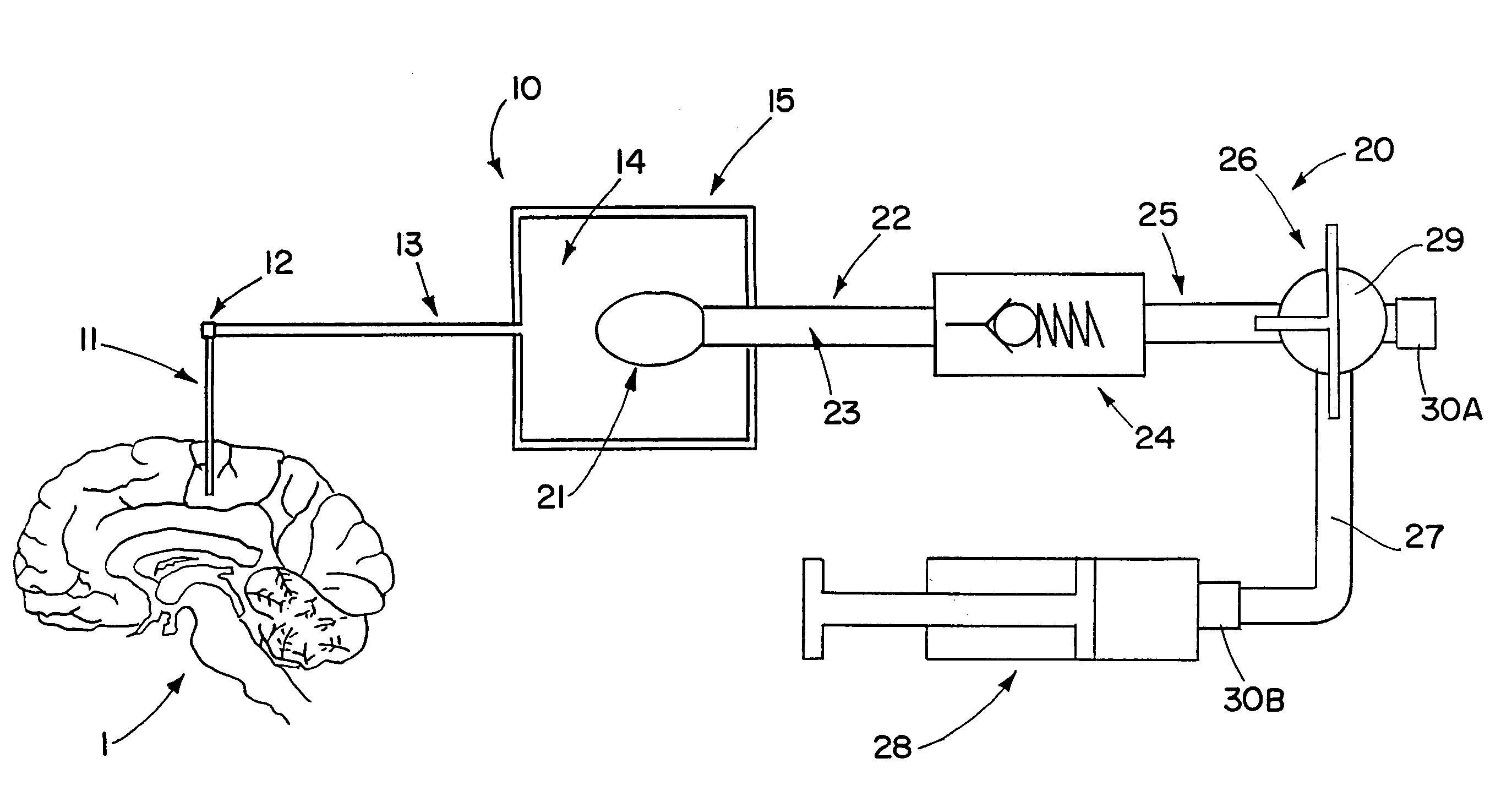 Drug supply system for CED (convection-enhanced delivery) catheter infusions